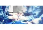 Outcome Measurement for Medical Devices