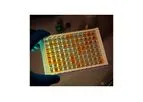 Kephera - Rapid Testing Tools for Chagas Disease
