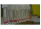 Saliva Cotinine Testing
