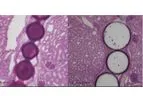 ABK - Model Easi-Vue - Embolic Microspheres
