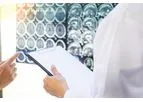 Traumatic Brain Injury (TBI) Treatment