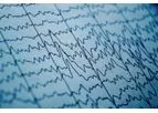Daily Live EEG Reviews & Reports Service