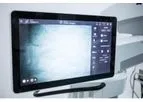 TIVATO - Model 700 - Surgical Microscopes