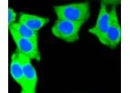 Huabio - Model MSH2- ER1803-86 - Rabbit Polyclonal Antibody