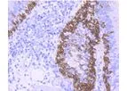 Huabio - Model 17 - ER1901-01 - Cytokeratin Rabbit Polyclonal Antibody