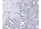 Huabio - Model ST05-25 -ET1609-67 - HIF-1 Beta Recombinant Rabbit Monoclonal Antibody