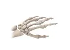 Osteotec - Silicone Finger Implant