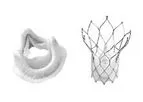 Novostia - Current Artificial Tissue Heart Valve