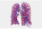 Fluidda - Functional Respiratory Imaging (FRI) Technology