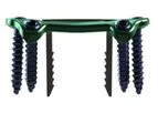 Model DynaForce - Staple Compression Plates