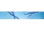 Inoviq - Model NETs - Biomarker Capture Platform Technology