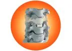 Biotechni - Model Anatomix-C - Anterior Cervical Cage