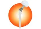 Biotechni - Gyptis Cup Semi Retentive Cemented