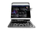 CHISON - Model EBit 50 - Portable Ultrasound Machine