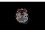 Model CAM-H2 - Consists of an Her2-Targeting Single-Domain Antibody