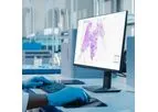 Aiforia - Clinical AI Model for Diagnostic Support Services