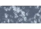 DeltEx DRI CAR-T - Model INB-300 - Gamma-Delta T Cells
