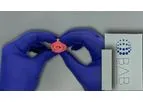 Bi-Ostetic Foam - Sterile Bone Graft Composed