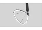 AMEND - Mitral Repair Implant
