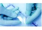 Inforce - Amniotic Membrane Allografts