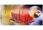 GCell - Autologous Tissue Suspension - Microgreft