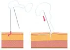 Spring Thread - Cosmetic Thread