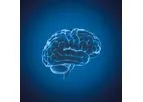 Myrian - Version XP-Brain - Head Perfusion CT