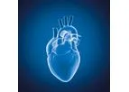Myrian - Version XP-Vessel and XP-Cardiac - Multi-Modality Visualization of Vessel Analysis Software