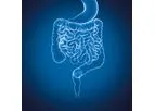 Myrian - Version XP-Colon - Optimize Multi-Modality Oncology Software