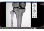 Surgeon Checklist - Version Trauma - Confirm Proper Alignment, Positioning, Accuracy of Correction