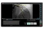 Medis Suite - Version XA - Industry-Leading Defacto Standard and Vendor Independent Software
