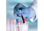 DiagnoLung - Non-Invasive Early Detection Test Cutting Edge Liquid Biopsy Technology for Lung Cancer