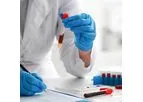 PancreaDix - Non-Invasive Signature in Blood Test Cutting Edge Liquid Biopsy Technology
