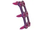 Blade - Anterior Cervical Plate System