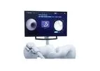 Galaxy - Model TiLT+ - Real-Time Lesion Visionary Technology
