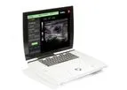 Sonoscanner - Model Ondina - Hybrid Portable Ultrasound Scanner