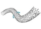 Amg - Model FACILE Advance - Self Expanding Stent