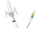 J-Valve - Model TAVI/TAVR - Transapical  System