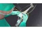 Pixee - Model Knee+ - Augmented Reality Navigation Device for Total Knee Arthroplasty