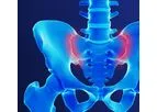 Alevio - Model SI - Diagnosing Sacroiliac Joint Pain