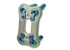 AccuFit - Model ALIF - Lumbosacral Fixation Plate System