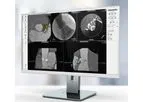 3mensio - Aortic Valve Replacement Software
