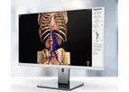 3mensio - Vascular Surgery Software