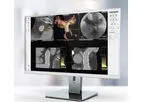 3mensio - Percutaneous Pulmonary Valve Implantation (PPVI)  Planning Software