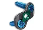 Boomerang - Versatile Anterior Cervical Plate System