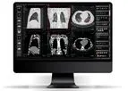 Alma - Version Multiplanar Reconstruction (MPR) - DICOM viewer