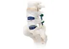 ENZA - Model A- ALIF - Titanium Implant