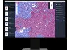 Lunit - Version SCOPE IO - AI-Powered Biomarker for Immuno-Oncology