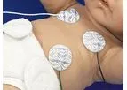 NeoLead - Model Standard - ECG Electrodes