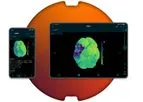 Brainomix - Version e-CTP - Robust, Reliable CT Perfusion Results